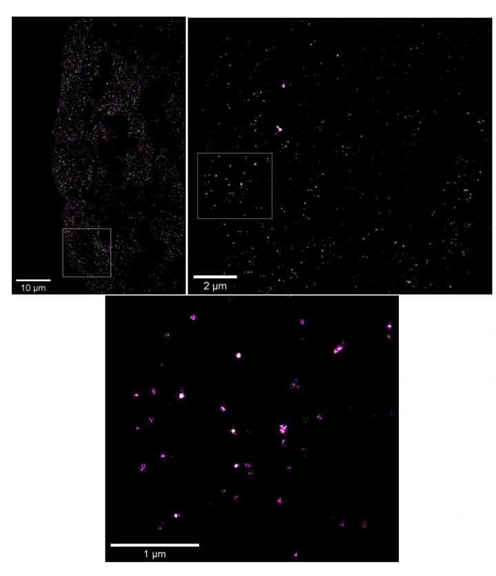 SARS-CoV-2 virus infects human liver organoids