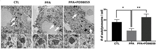 Autophagy Disruption