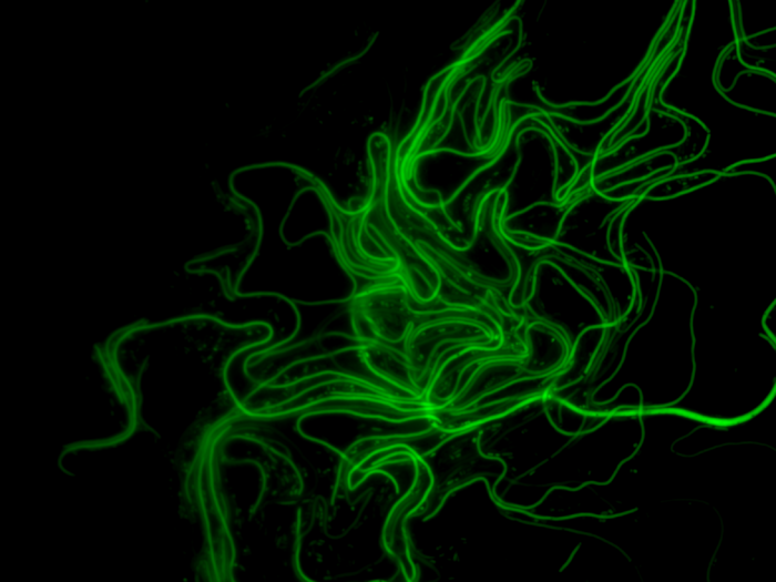 UpEC filaments after UTI