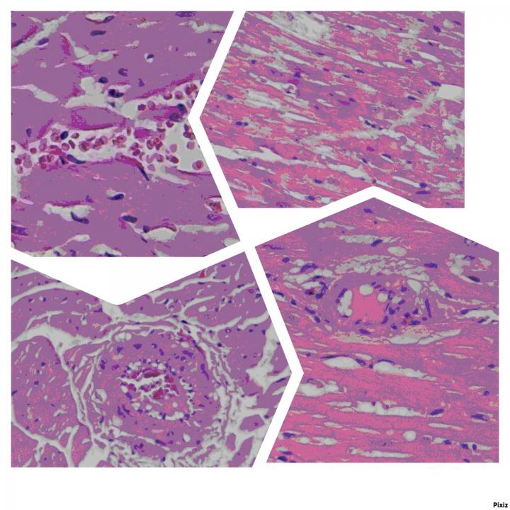 Fig. 2. The Structure of the Left Ventricular Myocardium of Animals of the Experimental Series