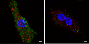 Innate Immune Response Against HIV