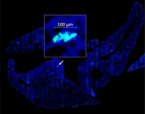 Metastatic Delivery