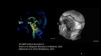 4D animation models of the brain in motion