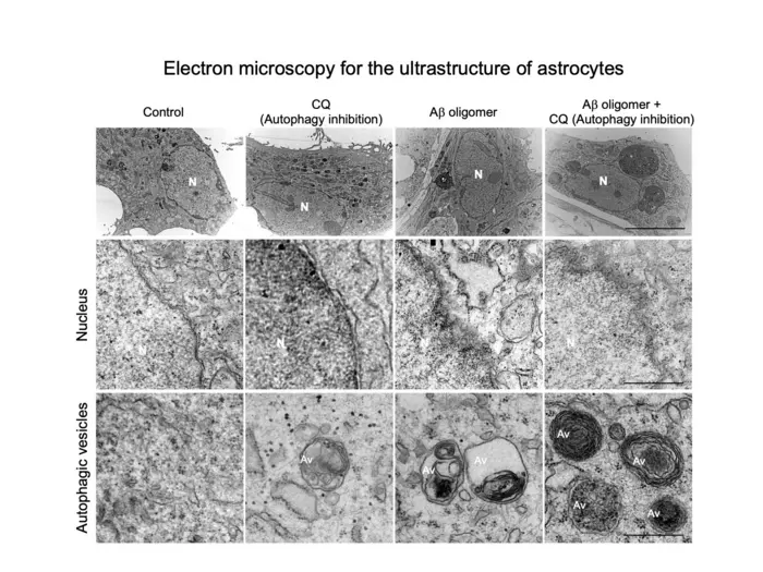 When autophagy function in astrocytes is inhibited, autophagic vesicles are accumulated, consequently preventing the removal of Aβ