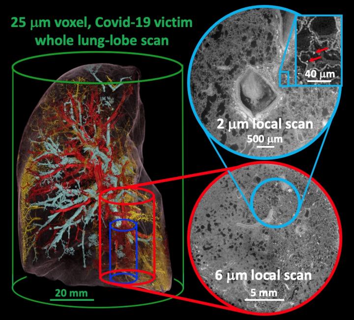 ESRF and UCL scientists awarded Chan Zuckerberg Initiative grant for human organ imaging project