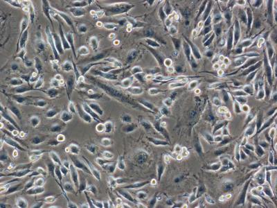 Triple-negative Breast Cancer Cells