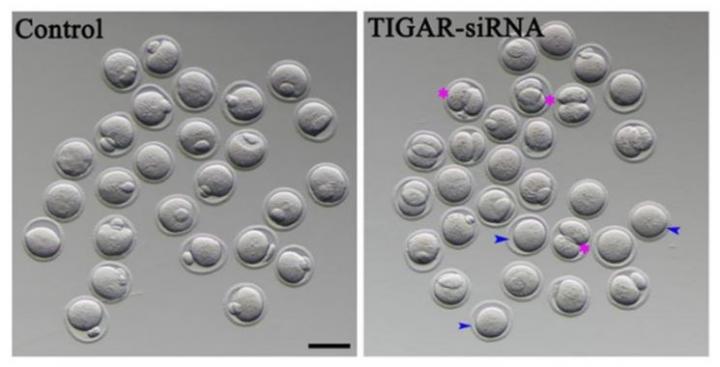 Antioxidant Protein, Decreased by Obesity, Promotes Egg Cell Maturation