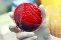 Screening for Antibiotic-Resistant Bacteria