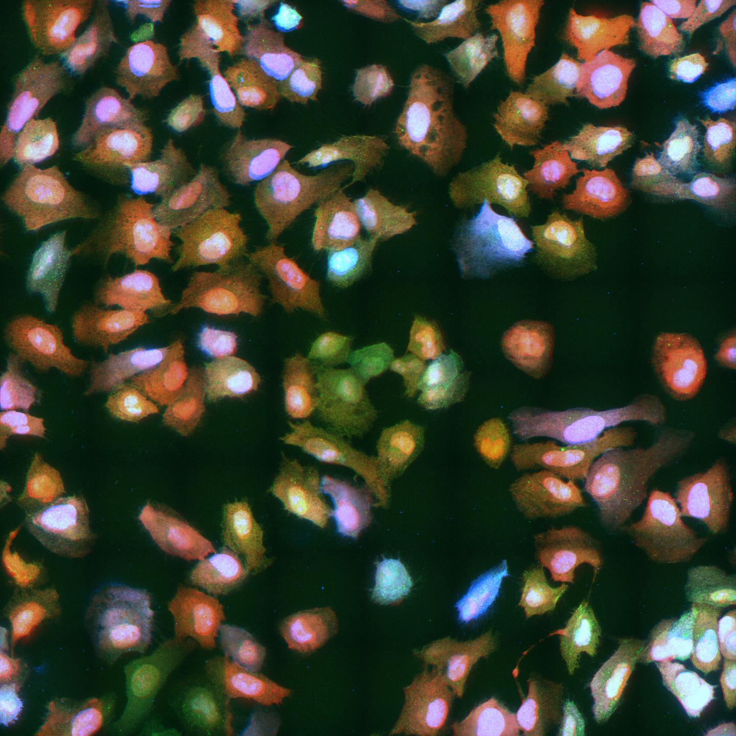 Competition between virus and host cells