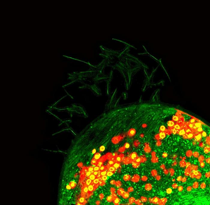 Paramecium bursaria with Chlorella spp.