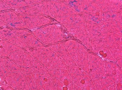 Gene Therapy Treated Muscle