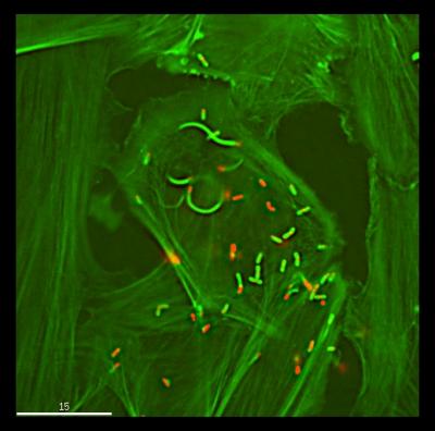 Listeria Monocytogenes Invading Cardiac Cells