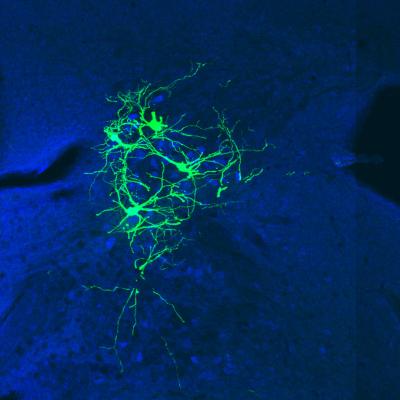 New Rabies Virus Strain Traces Circuits