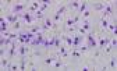 Intraventricular Injection of Amyloid β-Peptide