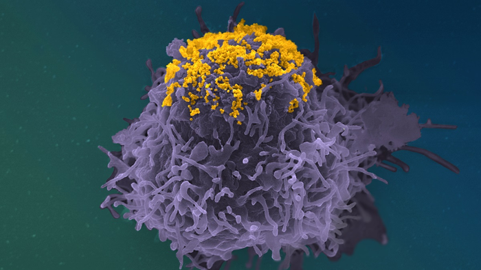HIV particles accumulating on the surface of an infected cell