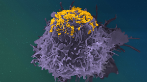 HIV particles accumulating on the surface of an infected cell