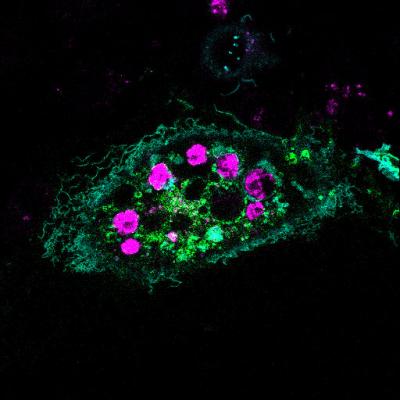 HeLa Eating Dying Cells