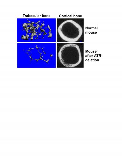 Loss of Stem Cells Correlates with Premature Aging