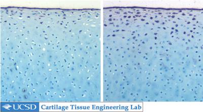 Flexed and Immobile Joint Cartilage