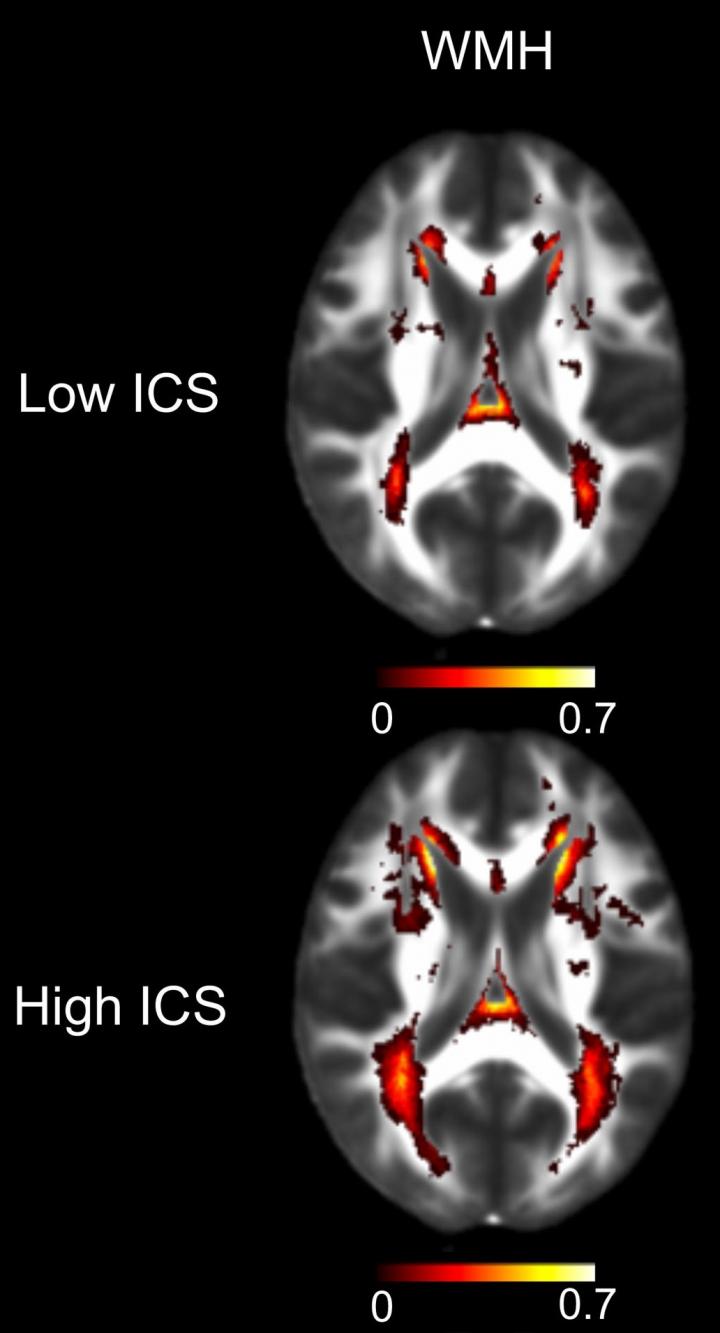 MRI Scans