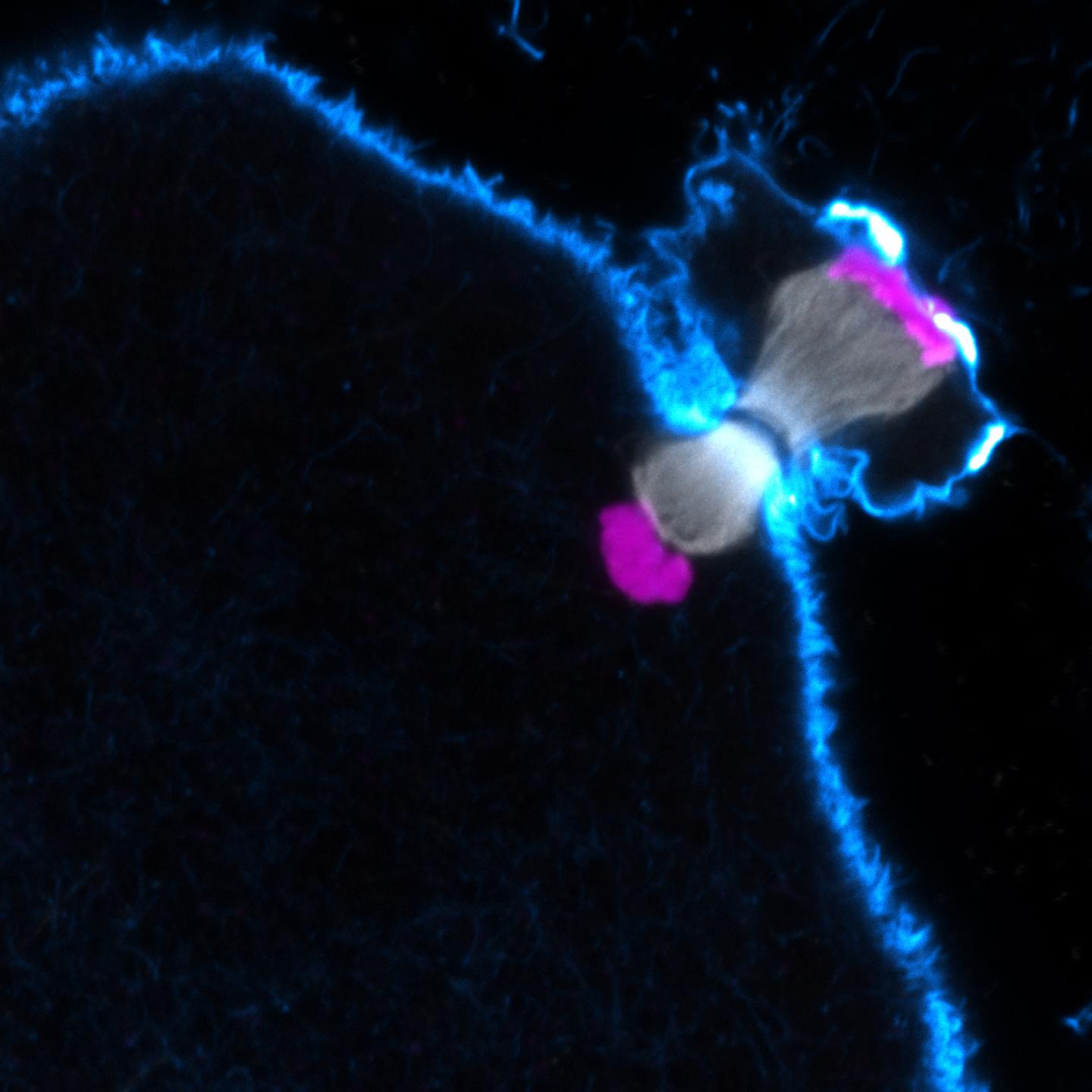 Spindle Assembly Key to Chromosome Errors in Human Eggs (2 of 6)