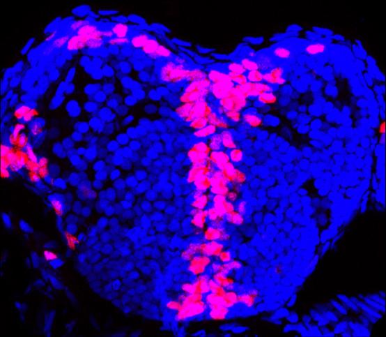 Progenitor Cells in Zebrafish Brain
