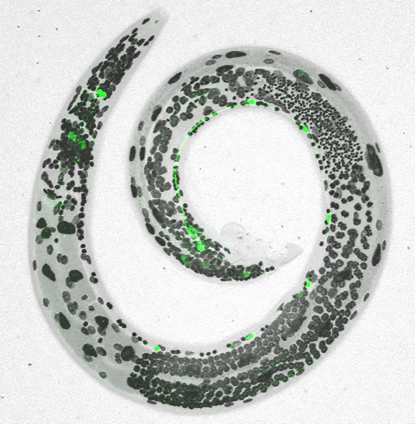 Nerve-Wracking Stress Shapes Worm Circuits