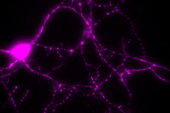 The Role of an Energy-Producing Enzyme in Treating Parkinson’s Disease