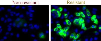 Infection of Liver Cells