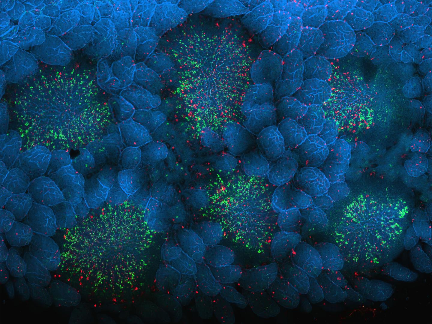 Prion Study Reveals How Disease Spreads from Gut to Brain