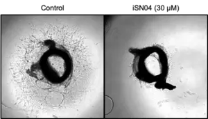 iSN04, an anti-nucleolin myogenic DNA aptamer that inhibits angiogenesis