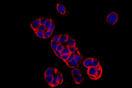 Antibody Drug Conjugate Ado-trastuzumab Emtansine