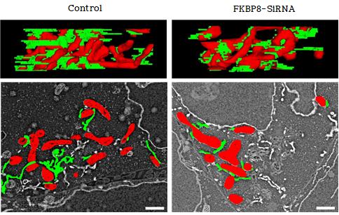 Changes in the Three-Dimensional Structure of MAM