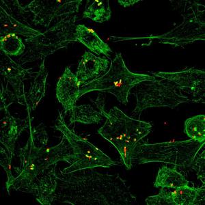 Bacteria infecting cells