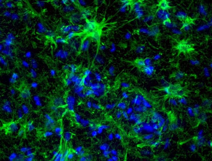 Astrocytes