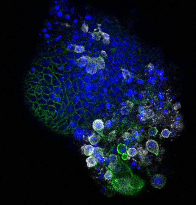 Intestinal organoid infected with coronavirus SARS-CoV-2