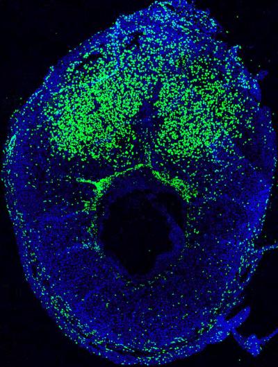 Cells that Make Bone Marrow also Travel to the Womb to Help Pregnancy