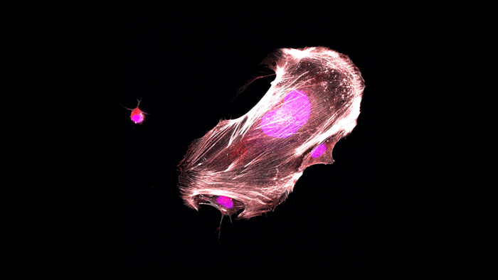 Transformed Ewing sarcoma cell