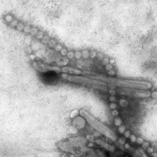 Influenza A H7N9