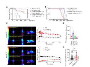 Neuronal C/EBPβ escalation shortens the life span of mice, leading to neural excitation