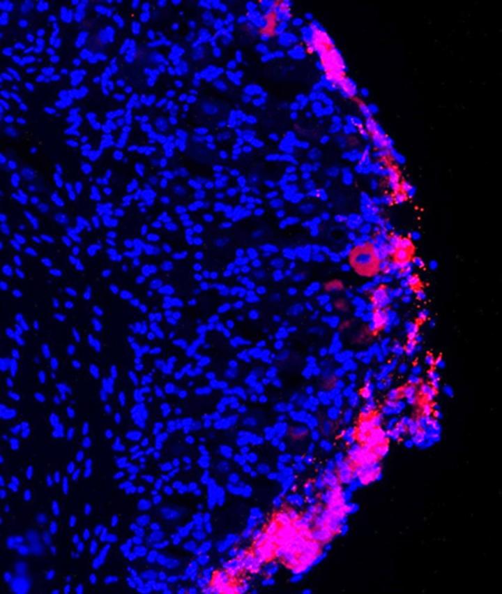 Bone Marrow Stromal Cells