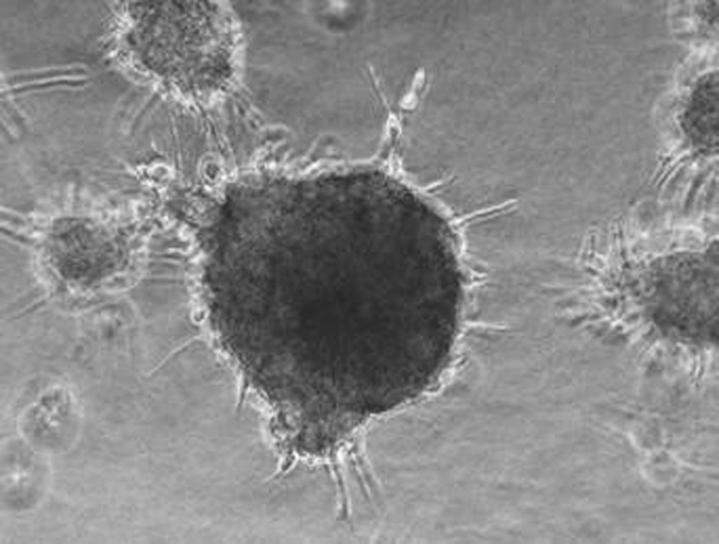 Cancer Cell Aggressiveness, Measured by Ability to Absorb Small Particles, May Assist Diagnosis (1 of 8)