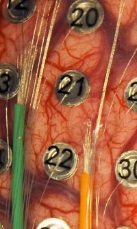 Microelectrode Arrays on the Brain