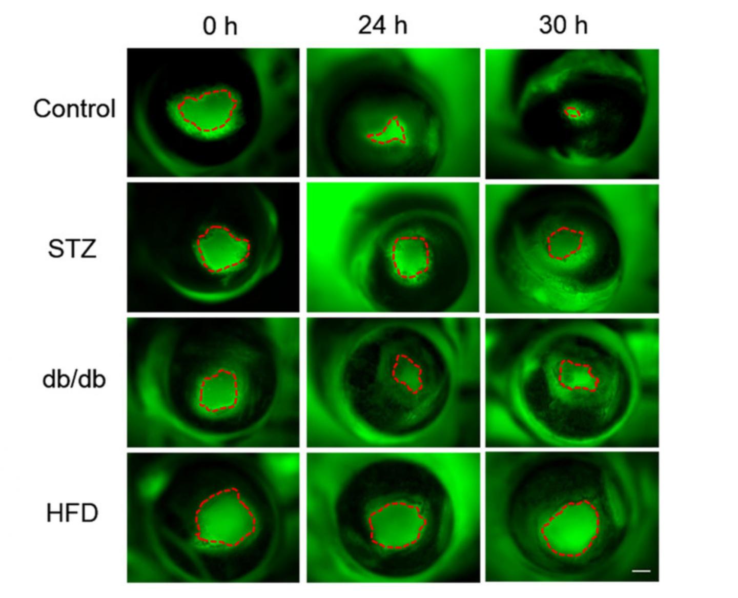 Electric fields weaker in slowhealing diabet EurekAlert!