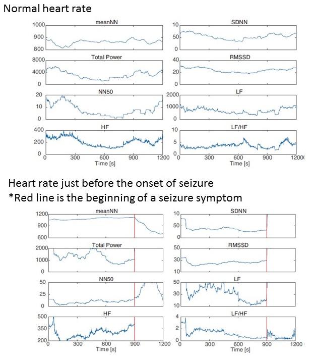 Traditional Analysis of Heart Rate Variability Using ECG