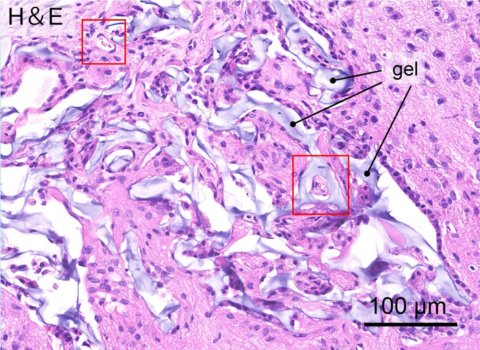 Neural stem cells at 64 days after transplantation into hydrogel