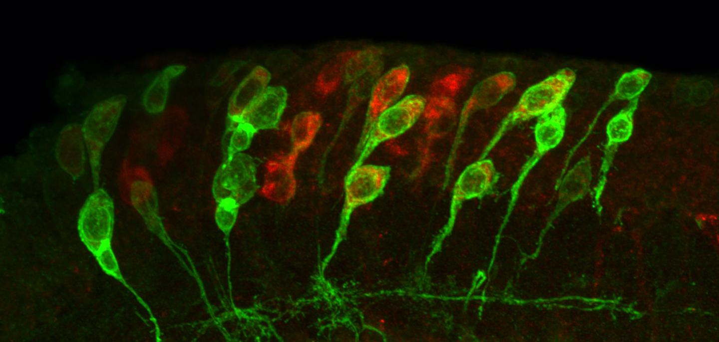 Neural Stem Cells in the Fruit Fly Brain