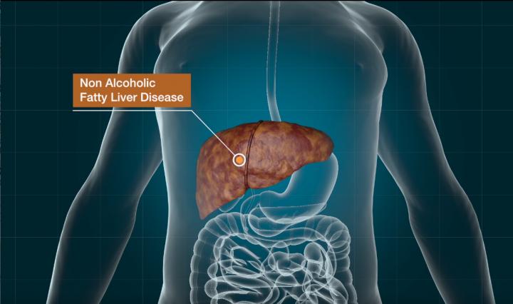 Modifing the Parkinson's Drug