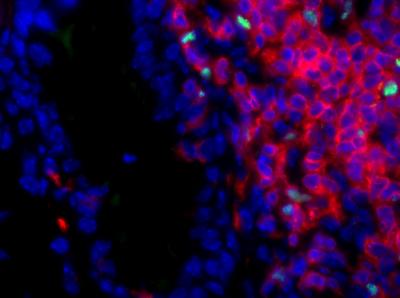 Tissues Derived from Embryonic Stem Cells Could Help to Pacify the Immune System