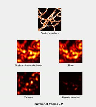 High-resolution Photoacoustic Imaging Video